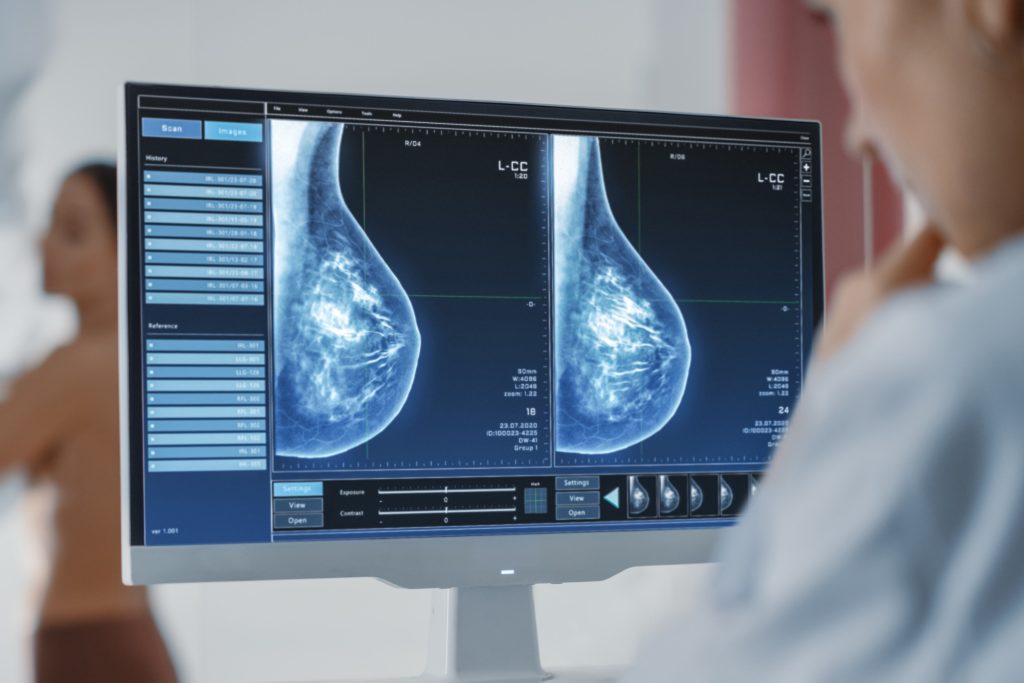 ماموگرافی چیست و چگونه انجام میشود؟