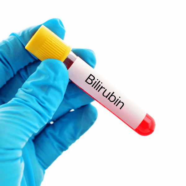 آزمایش Bilirubin (بیلیروبین؛ رنگدانه صفراوی)