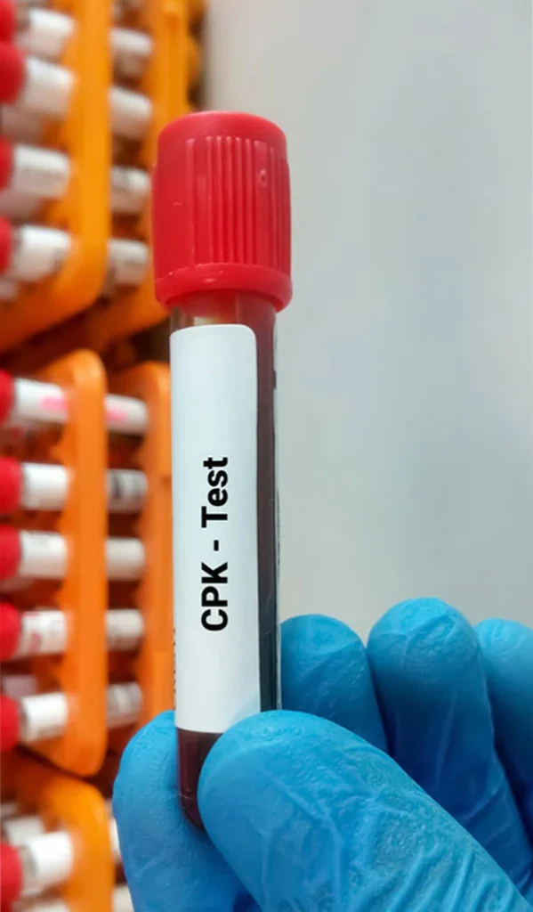 آزمایش کراتین کیناز (CPK)