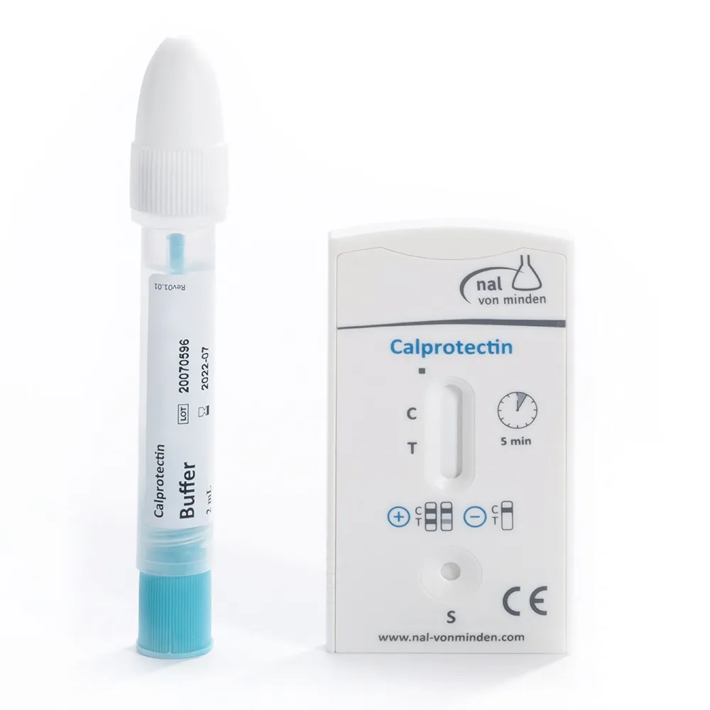 آزمایش کالپروتکتین (Calprotectin)