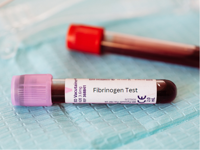 آزمایش fibrinogen (پروتئین فیبرینوژن)