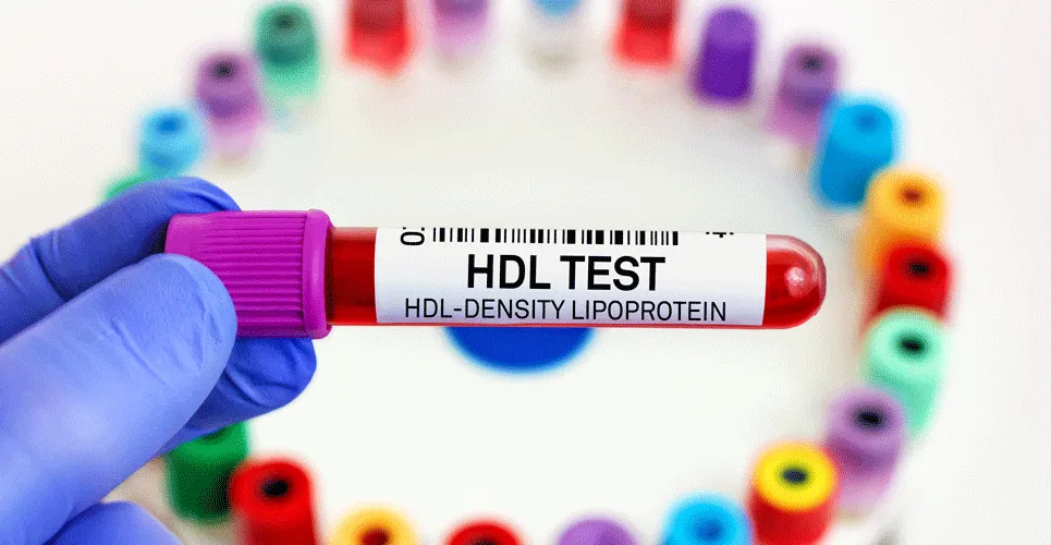 آزمایش HDL (High-Density Lipoprotein)
