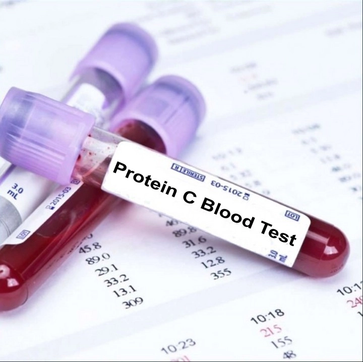 آزمایش پروتئین C (Protein C)