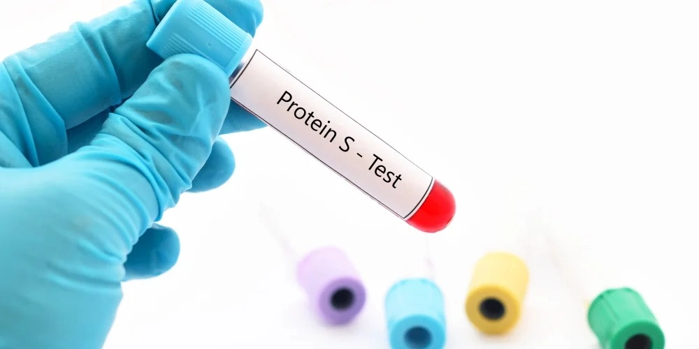 آزمایش پروتئین S (Protein S)