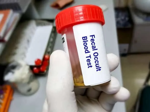 آزمایش Occult Blood (OB)