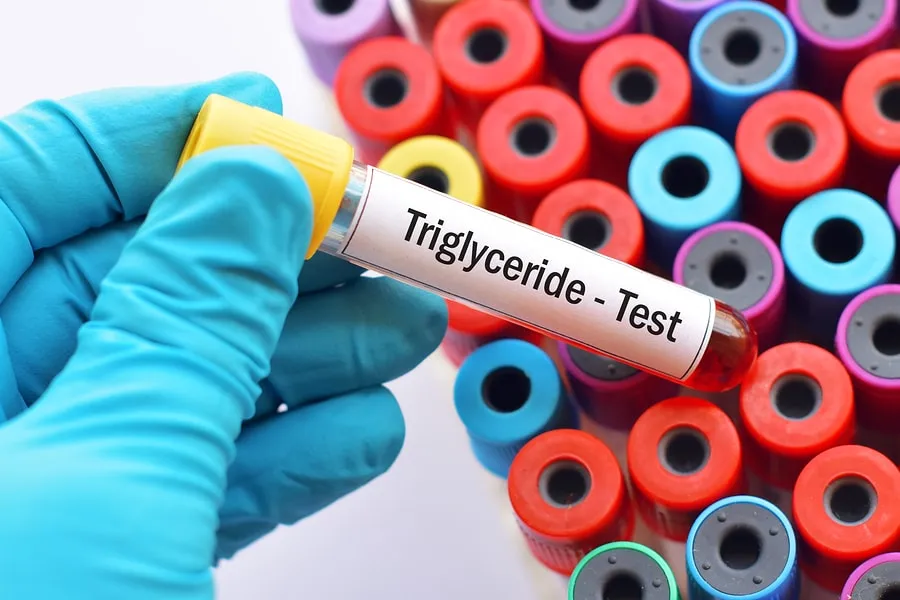 آزمایش تریگلیسیرید (Triglycerides Test)