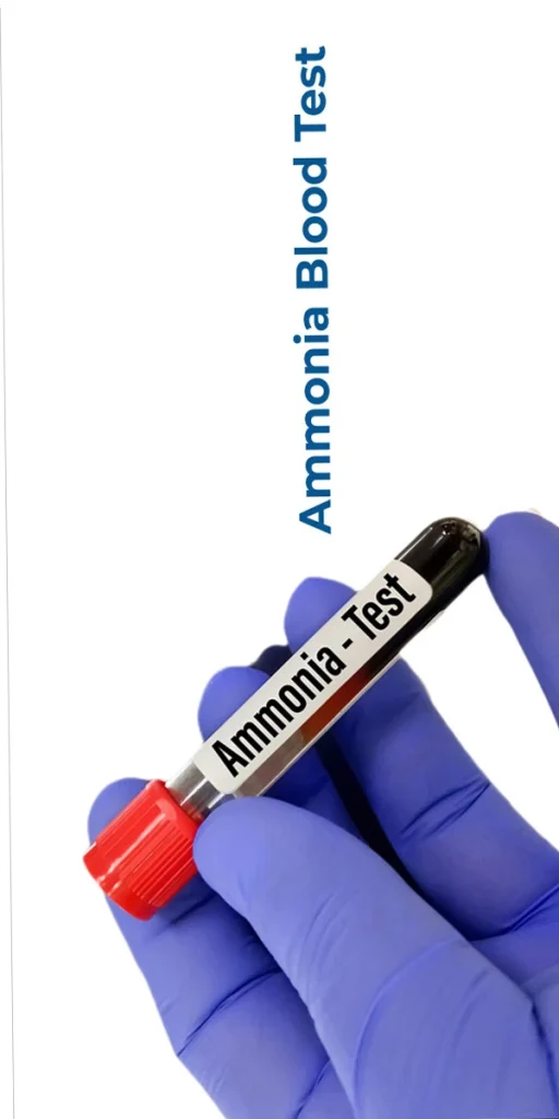آزمایش آمونیاک (Ammonia)