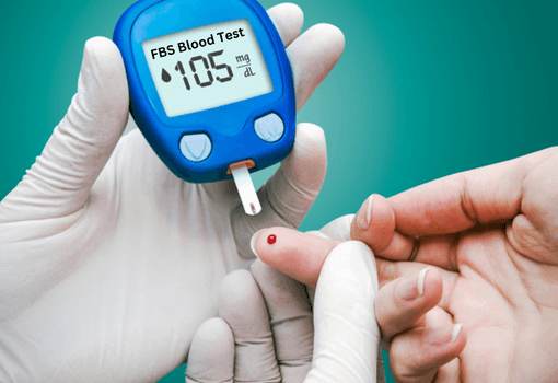آزمایش FBS (Fasting Blood Sugar) یا قند خون ناشتا