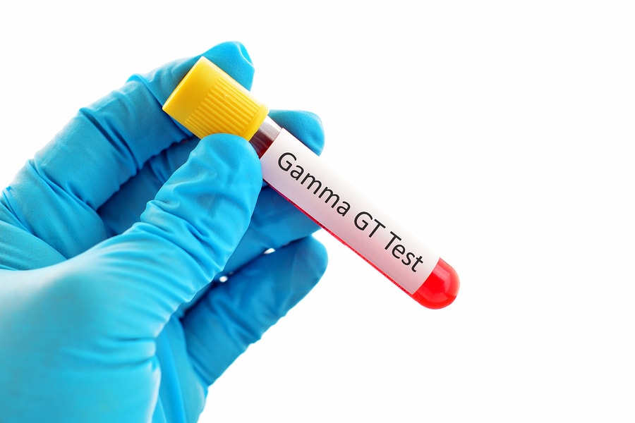 آزمایش GGT (گاما-گلوتامیل ترانسفراز)