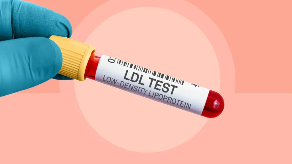 آزمایش LDL (Low-Density Lipoprotein)