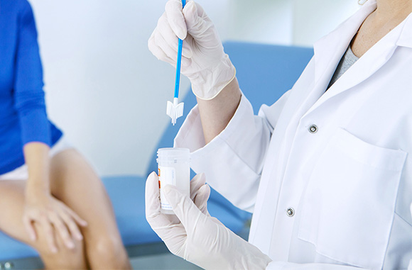 آزمایش Pap Smear(اسمیر پاپانیکولاو)