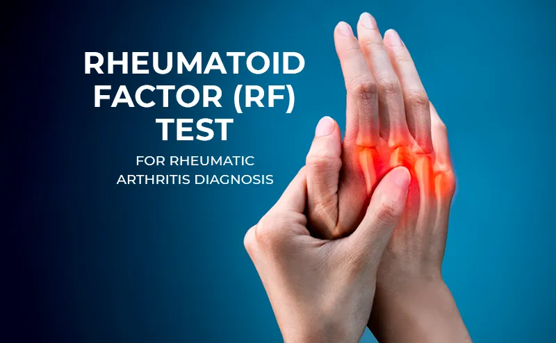 آزمایش فاکتور روماتوئید (RF)