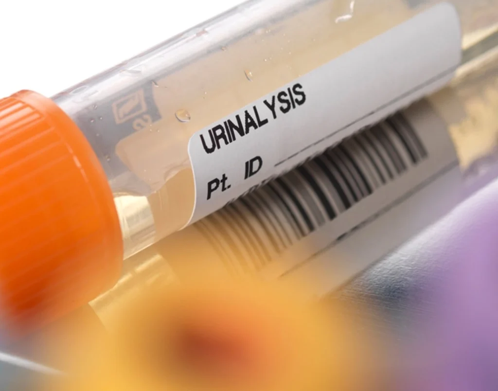 آزمایش کشت ادرار (Urine Culture)